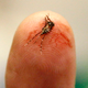 Illustration for article titled The Many Ways Were Using Mutant Mosquitos to Eradicate Disease
